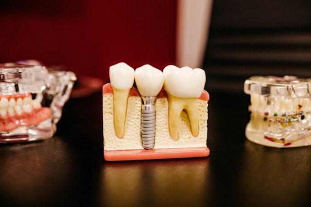 The Best Dental Implant Training Courses for General Dentists
